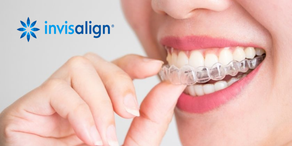 Ortodonzia-invisibile-Invisalign-dentista-a-torino-dott-ivaniuc
