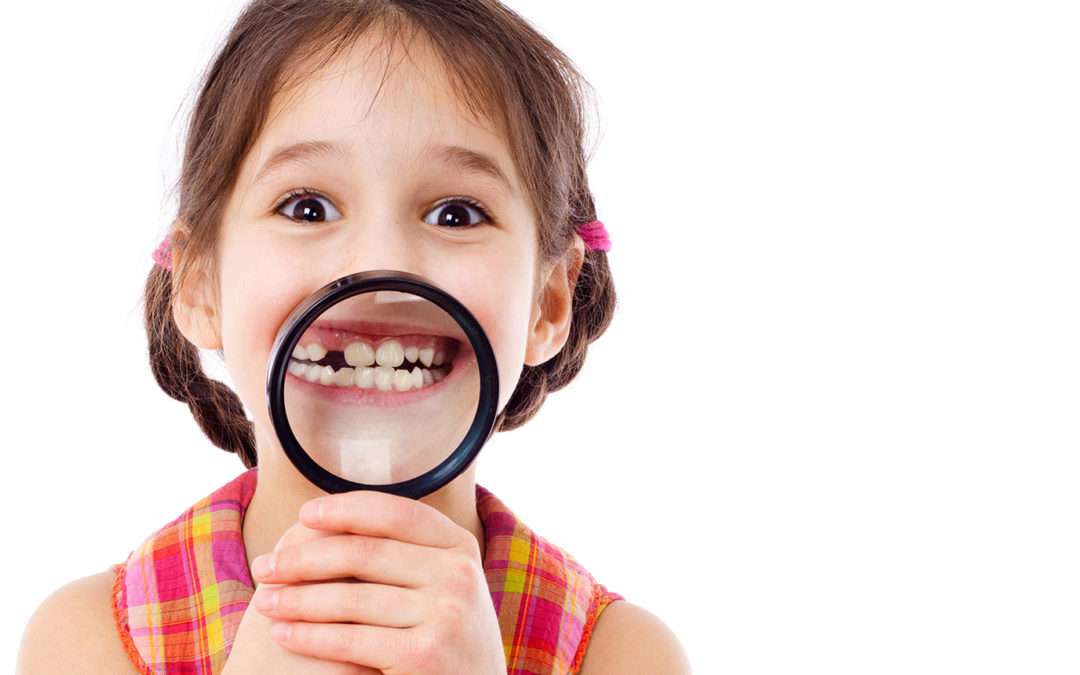 implantologia pediatrica denti cariati nei bambini